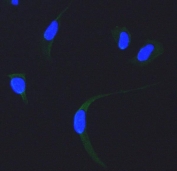 Immunofluorescent staining of FFPE human HeLa cells with SDHA antibody (green) and DAPI nuclear stain (blue). HIER: steam section in pH6 citrate buffer for 20 min.