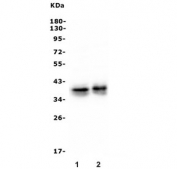 Western blot testing of human 1) A549 and 2) PC-3 lysate with Msi1 antibody. Predicted molecular weight ~39 kDa.