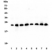 Western blot testing of human 1) HEK293, 2) HeLa, 3) A549, 4) placenta, 5) HepG2, 6) Caco-2, 7) ThP-1 and 8) Raji lysate with RAB11B antibody. Predicted molecular weight ~24 kDa.