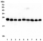 Western blot testing of rat 1) brain, 2) lung, 3) spleen, 4) C6 and mouse 5) brain, 6) lung, 7) spleen, 8) Neuro-2a and 9) RAW264.7 lysate with RAB11B antibody. Predicted molecular weight ~24 kDa.