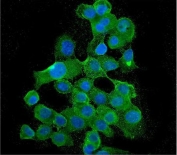 Immunofluorescent staining of FFPE human A431 cells with BUB1B antibody (green) and DAPI nuclear stain (blue). HIER: steam section in pH6 citrate buffer for 20 min.
