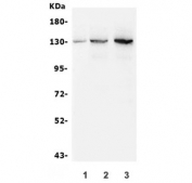 Western blot testing of human 1) HeLa, 2) HEK293 and 3) K562 lysate with BUB1B antibody. Predicted molecular weight ~120 kDa.
