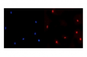 Immunofluorescent staining of FFPE human A431 cells with NUP214 antibody (green) and DAPI nuclear stain (blue). HIER: steam section in pH6 citrate buffer for 20 min.