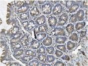 IHC staining of FFPE rat intestine with CLTC antibody. HIER: boil tissue sections in pH8 EDTA for 20 min and allow to cool before testing.