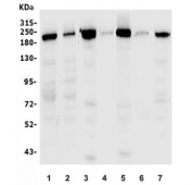 Western blot testing of 1) human HEK293, 2) human Raji, 3) rat brain, 4) rat kidney, 5) mouse brain, 6) mouse kidney and 7) mouse ANA-1 lysate with CLTC antibody. Predicted molecular weight ~192 kDa.