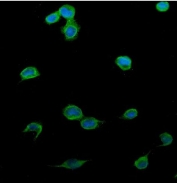Immunofluorescent staining of FFPE human U-2 OS cells with Patched 2 antibody (green) and DAPI nuclear stain (blue). HIER: steam section in pH6 citrate buffer for 20 min.