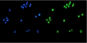 Immunofluorescent staining of FFPE human U-2 OS cells with TET1 antibody (green) and DAPI nuclear stain (blue). HIER: steam section in pH6 citrate buffer for 20 min.