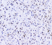 IHC staining of FFPE rat brain with POLR2A antibody. HIER: boil tissue sections in pH8 EDTA for 20 min and allow to cool before testing.