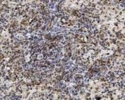 IHC staining of FFPE mouse spleen with U2AF65 antibody. HIER: boil tissue sections in pH8 EDTA for 20 min and allow to cool before testing.