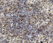 IHC staining of FFPE mouse spleen with U2AF65 antibody. HIER: boil tissue sections in pH8 EDTA for 20 min and allow to cool before testing.