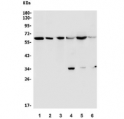 Western blot testing of 1) human HEK293, 2) human ThP-1, 3) human U-2 OS, 4) rat brain, 5) rat spleen and 6) mouse brain lysate with U2AF65 lysate. Expected molecular weight ~65 kDa.