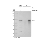 Immunoprecipitation of U2AF65 protein from 500ug of human A549 whole cell lysate with 2ug of U2AF65 antibody.
