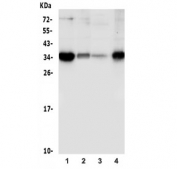 Western blot testing of human 1) PC-3, 2) HepG2, 3) K562 and 4) A375 lysate with Sprouty 4 antibody. Predicted molecular weight ~35 kDa.