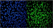 Immunofluorescent staining of FFPE human HeLa cells with USP16 antibody (green) and DAPI nuclear stain (blue). HIER: steam section in pH6 citrate buffer for 20 min.