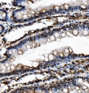 IHC staining of FFPE rat intestine with USP16 antibody. HIER: boil tissue sections in pH8 EDTA for 20 min and allow to cool before testing.