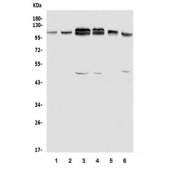 Western blot testing of human 1) HeLa, 2) U-2 OS, 3) T-47D, 4) Caco-2, 5) monkey heart and 6) monkey kidney lysate with USP16 antibody. Predicted molecular weight ~94 kDa.