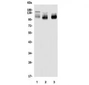 Western blot testing of 1) rat spleen, 2) rat thymus and 3) mouse thymus lysate with Psgl1 antibody. Expected molecular weight: 42-120 kDa, depending on glycosylation level.