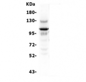Western blot testing of human K562 lysate with USP15 antibody. Expected molecular weight ~112 kDa.