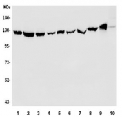 Western blot testing of human 1) HeLa, 2) U-87 MG, 3) HT1080, 4) HEK293, 5) SK-OV-3, 6) monkey COS-7, 7) human K562, 8) human SGC-7901, 9) rat heart and 10 mouse heart lysate with Vinculin antibody. Predicted molecular weight ~124 kDa.