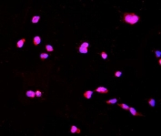 Immunofluorescent staining of FFPE mouse HEPA1-6 cells with CTHRC1 antibody (red) and DAPI nuclear stain (blue). HIER: steam section in pH6 citrate buffer for 20 min.