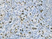 IHC staining of FFPE human spleen tissue with CXCR2 antibody. HIER: boil tissue sections in pH8 EDTA for 20 min and allow to cool before testing.
