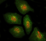 Immunofluorescent staining of FFPE human A549 cells with DBF4 antibody (red) and Beta Actin antibody (green). HIER: steam section in pH6 citrate buffer for 20 min.