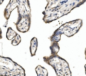 IHC staining of FFPE human placenta with DLL1 antibody. HIER: boil tissue sections in pH8 EDTA for 20 min and allow to cool before testing.
