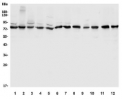 Western blot testing of 1) human HeLa, 2) monkey COS-7 and human 3) Jurkat, 4) Raji, 5) SW620, 6) HepG2, 7) U-2 OS, 8) rat heart, 9) rat C6, 10) mouse heart, 11) mouse Neuro-2a, 12) mouse RAW264.7 lysate with DLL1 antibody. Predicted molecular weight ~78 kDa.