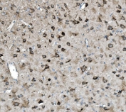 IHC staining of FFPE rat brain with GLS antibody. HIER: boil tissue sections in pH8 EDTA for 20 min and allow to cool before testing.