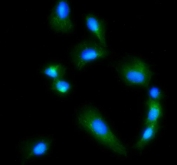 Immunofluorescent staining of FFPE human U-2 OS cells with GLS antibody (green) and DAPI nuclear stain (blue). HIER: steam section in pH6 citrate buffer for 20 min.