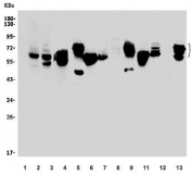 Western blot testing of 1) human placenta, 2) human U-87 MG, 3) human HeLa, 4) monkey kidney, 5) rat brain, 6) rat kidney, 7) rat heart, 8) rat skeletal muscle, 9) mouse brain, 10) mouse kidney, 11) mouse heart, 12) mouse skeletal muscle and 13) mouse Neuro-2a antibody. Predicted molecular weigh: 65-73 kDa.