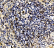 IHC staining of FFPE mouse spleen with Irf3 antibody. HIER: boil tissue sections in pH8 EDTA for 20 min and allow to cool before testing.