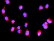 Immunofluorescent staining of FFPE mouse HEPA1-6 cells with Irf3 antibody (red) and DAPI nuclear stain (blue). HIER: steam section in pH6 citrate buffer for 20 min.