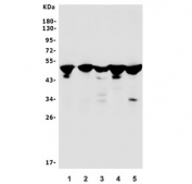 Western blot testing of mouse 1) lung, 2) thymus, 3) RAW264.7, 4), Ana-1 and 5) SP2/0 lysate with Irf3 antibody. Predicted molecular weight ~47 kDa.