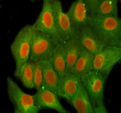 Immunofluorescent staining of FFPE human U-2 OS cells with FEN-1 antibody (red) and Beta Tubulin mAb (green). HIER: steam section in pH6 citrate buffer for 20 min.