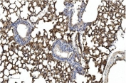 IHC staining of FFPE mouse lung with CAV2 antibody. HIER: boil tissue sections in pH8 EDTA for 20 min and allow to cool before testing.