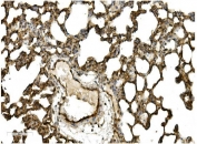 IHC staining of FFPE rat lung with CAV2 antibody. HIER: boil tissue sections in pH8 EDTA for 20 min and allow to cool before testing.