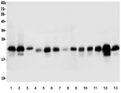 Western blot testing of human 1) HeLa, 2) A549, 3) U-2 OS, 4) K562, 5) HT1080, 6) Caco-2, 7) HEK293, 8) monkey COS-7, 9) rat skeletal muscle, 10) rat heart, 11) mouse skeletal muscle, 12) mouse heart and 13) mouse NIH 3T3 lysate with CAV2 antibody. Predicted molecular weight ~18 kDa.