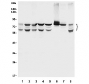 Western blot testing of human 1) A549, 2) MDA-MB-453, 3) HepG2, 4) Caco-2, 5) PC-3, 6) rat liver, 7) rat kidney and 8) mouse HEPA1-6 lysate with BCRP antibody. Expected molecular weight: 65-80 kDa depending on glycosylation level.
