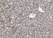 IHC staining of FFPE mouse liver with BCRP antibody. HIER: boil tissue sections in pH8 EDTA for 20 min and allow to cool before testing.