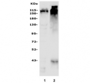 Western blot testing of mouse 1) brain and 2) ovary with AKAP12 antibody. Predicted molecular weight: ~191 kDa but can be seen at 250-305 kDa. 