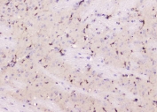 IHC staining of FFPE mouse brain with ALDH1L1 antibody. HIER: boil tissue sections in pH8 EDTA for 20 min and allow to cool before testing.