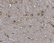 IHC staining of FFPE rat brain with ALDH1L1 antibody. HIER: boil tissue sections in pH8 EDTA for 20 min and allow to cool before testing.