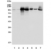 Western blot testing of 1) human HepG2, 2) human HEK293, 3) monkey liver, 4) monkey kidney, 5) rat liver, 6) rat kidney and 7) mouse liver lysate with ALDH1L1 antibody. Predicted molecular weight ~98 kDa.