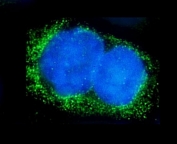 Immunofluorescent staining of FFPE human A431 cells with ALPL antibody (green) and DAPI nuclear stain (blue). HIER: steam section in pH6 citrate buffer for 20 min.