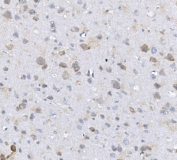 IHC staining of FFPE rat brain with ALPL antibody. HIER: boil tissue sections in pH8 EDTA for 20 min and allow to cool before testing.