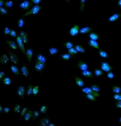 Immunofluorescent staining of FFPE human HeLa cells with Arginase 2 antibody (green) and DAPI nuclear stain (blue). HIER: steam section in pH6 citrate buffer for 20 min.