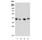 Western blot testing of 1) human HEK293, 2) human SW620, 3) rat kidney and 4) mouse kidney lysate with Arginase 2 antibody. Predicted molecular weight ~38 kDa.