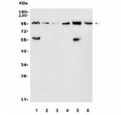 Western blot testing of human 1) HepG2, 2) A549, 3) A375, 4) MCF-7, 5) K562 and 6) mouse testis lysate with ATG9A antibody. Expected molecular weight: 94-110 kDa depending on glycosylation level.