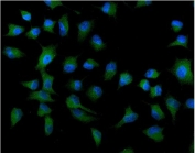 Immunofluorescent staining of FFPE human A549 cells with ATG9A antibody (green) and DAPI nuclear stain (blue). HIER: steam section in pH6 citrate buffer for 20 min.